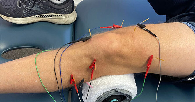 Dry Needling